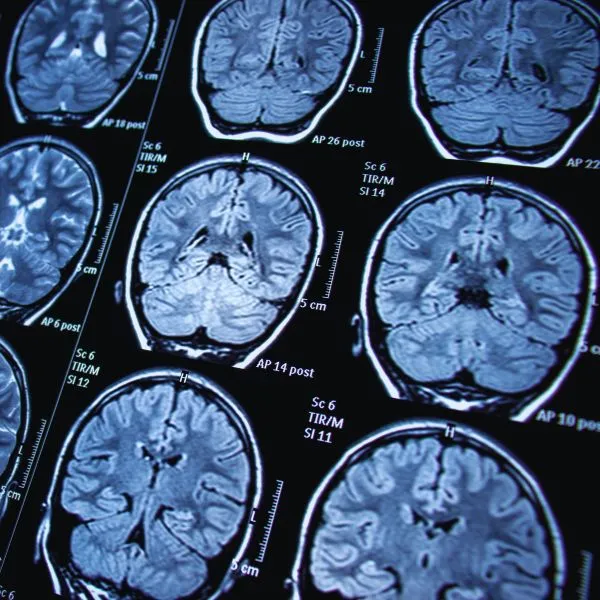 Neurologia