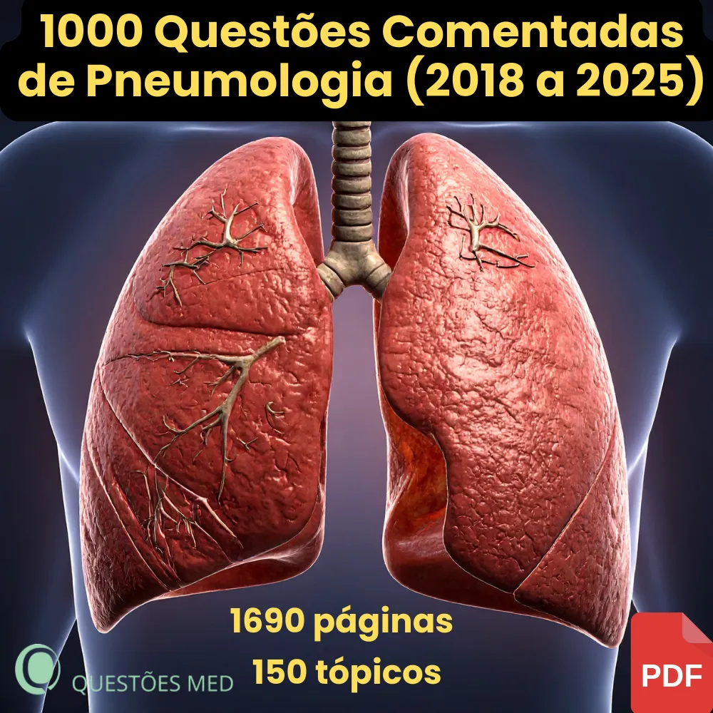 Revisão Intensiva de Pneumologia – 1000 Questões Comentadas