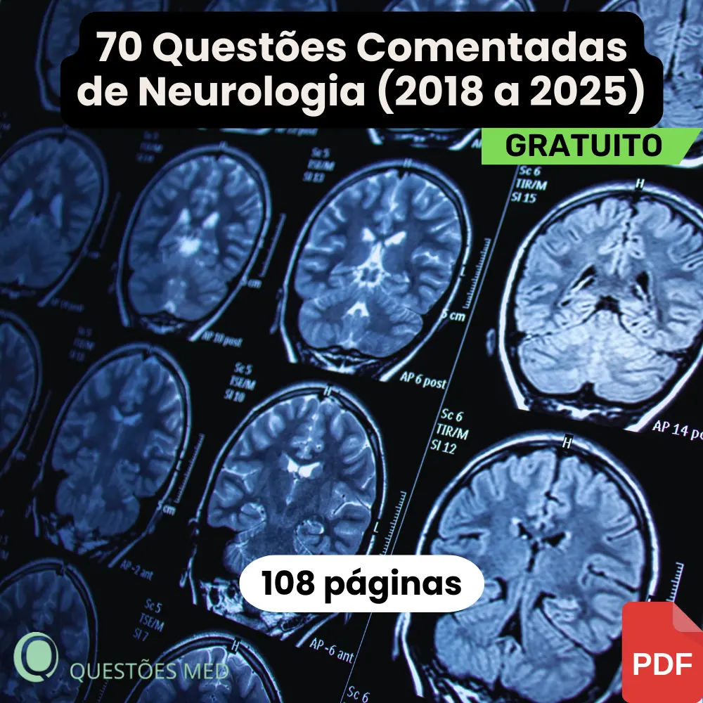Revisão Intensiva de Neurologia – Amostra Gratuita (2018–2025)