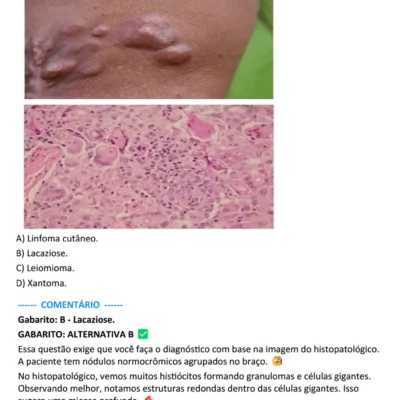 Amostra da página do E-book de questões comentadas de dermatologia para residência médica e prova de título - Questões MED (questoesmed.com).