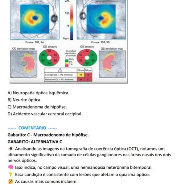 Amostra de conteúdo do ebook de Questões Comentadas da Prova de Títulos de Oftalmologia (CBO) - Questões MED