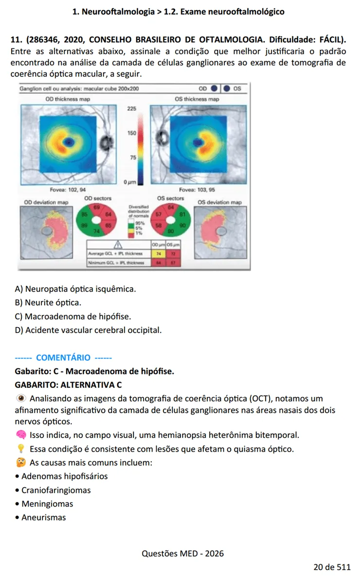 Amostra de conteúdo do ebook de Questões Comentadas da Prova de Títulos de Oftalmologia (CBO) - Questões MED